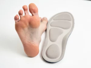 Blote voet met zichtbare drukplekken naast een orthopedische inlegzool op een witte klinische ondergrond.